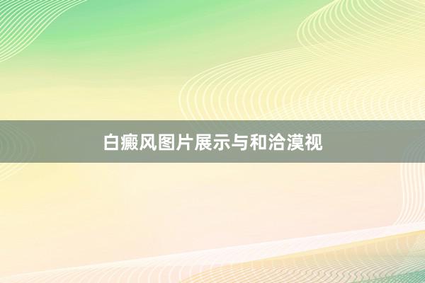 白癜风图片展示与和洽漠视